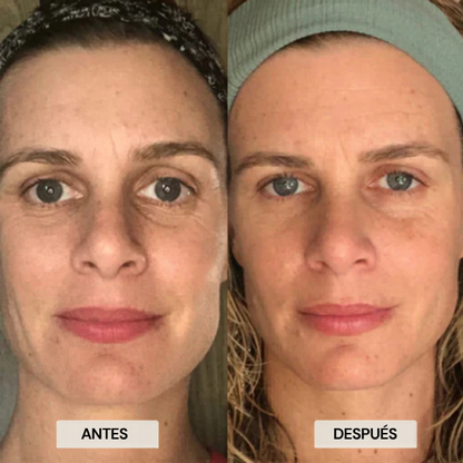 DrenaFace – Lymphatic Drainage Facial Brush