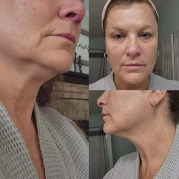 DrenaFace – Lymphatic Drainage Facial Brush