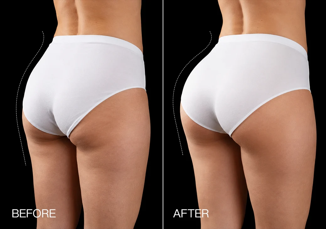 Comparison image supplied by merchant; provenance pending