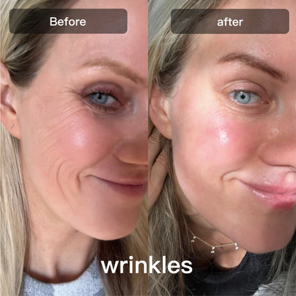 Swirise 7-in-1 LED Therapy